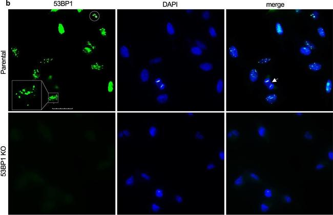 Rat IgG (H+L) Cross-Adsorbed Secondary Antibody in Immunocytochemistry (ICC/IF)