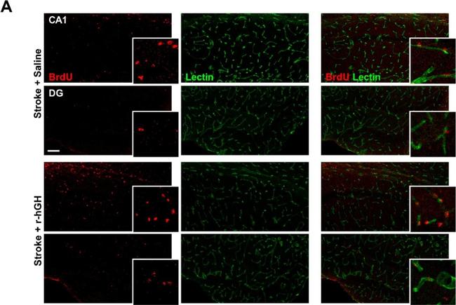 Mouse IgG (H+L) Highly Cross-Adsorbed Secondary Antibody in Immunohistochemistry (IHC)