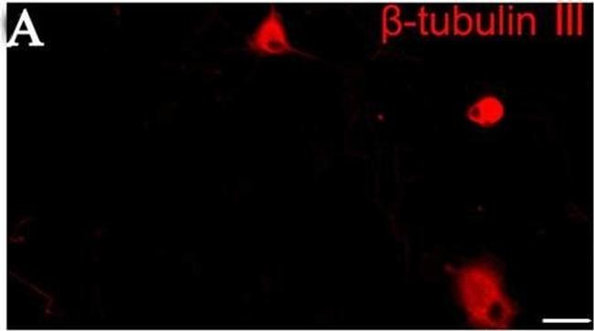 Mouse IgG (H+L) Highly Cross-Adsorbed Secondary Antibody in Immunocytochemistry (ICC/IF)