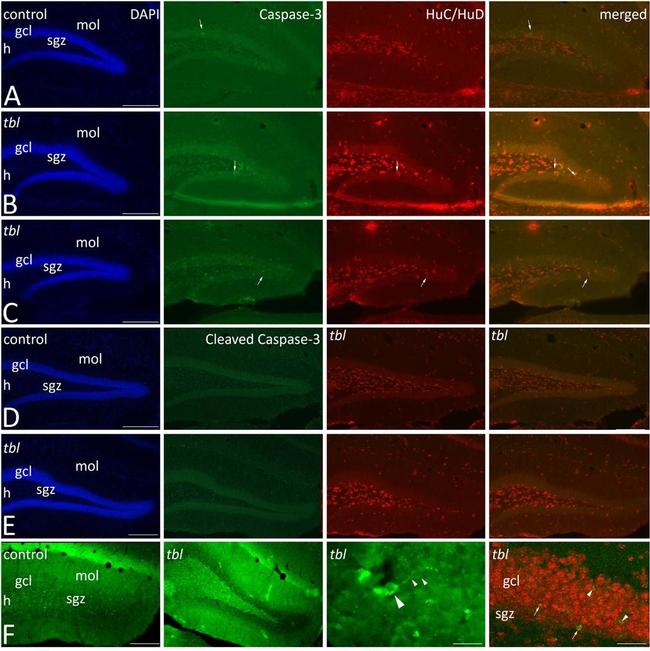 Mouse IgG (H+L) Highly Cross-Adsorbed Secondary Antibody in Immunohistochemistry (PFA fixed) (IHC (PFA))