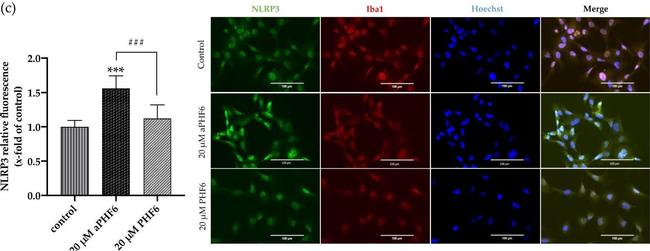 Mouse IgG (H+L) Highly Cross-Adsorbed Secondary Antibody in Immunocytochemistry (ICC/IF)