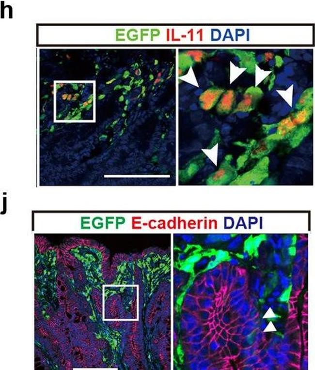 Rabbit IgG (H+L) Highly Cross-Adsorbed Secondary Antibody in Immunohistochemistry (IHC)