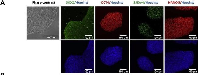 Rabbit IgG (H+L) Highly Cross-Adsorbed Secondary Antibody in Immunocytochemistry (ICC/IF)