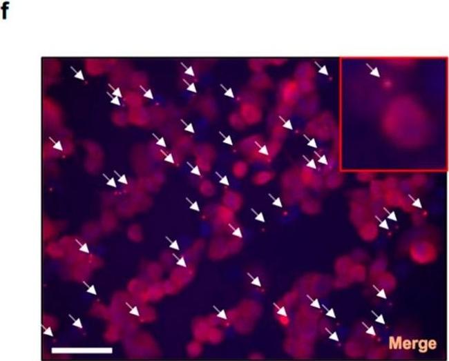 Rabbit IgG (H+L) Highly Cross-Adsorbed Secondary Antibody in Immunocytochemistry (ICC/IF)