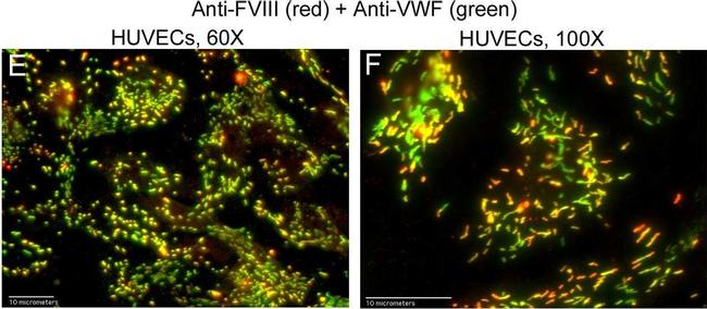 Rabbit IgG (H+L) Cross-Adsorbed Secondary Antibody in Immunocytochemistry (ICC/IF)