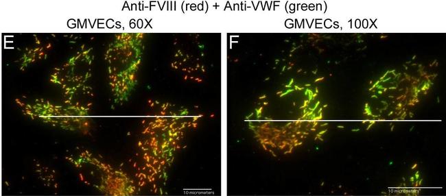 Rabbit IgG (H+L) Cross-Adsorbed Secondary Antibody in Immunocytochemistry (ICC/IF)