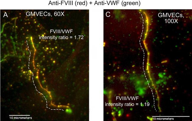 Rabbit IgG (H+L) Cross-Adsorbed Secondary Antibody in Immunocytochemistry (ICC/IF)