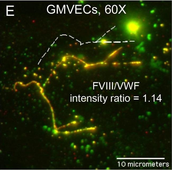 Rabbit IgG (H+L) Cross-Adsorbed Secondary Antibody in Immunocytochemistry (ICC/IF)