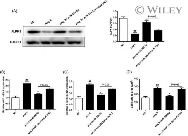 ALPK3 Antibody in Western Blot (WB)