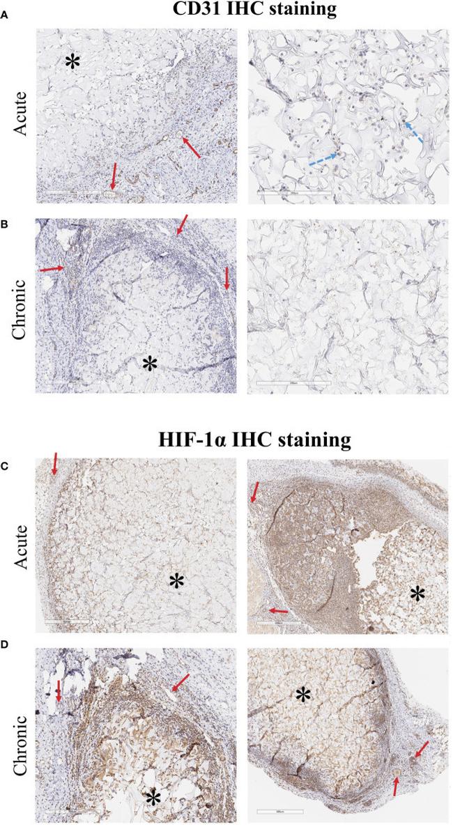 CD31 Antibody in Immunohistochemistry (IHC)