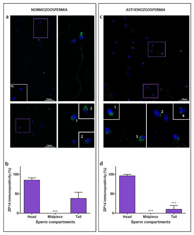 ZIP14 Antibody in Immunocytochemistry (ICC/IF)