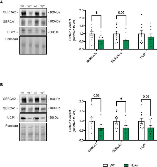 SERCA1 ATPase Monoclonal Antibody (VE121G9) (MA3-912)