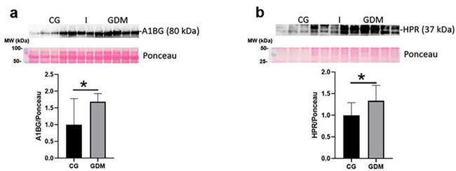 HPR Antibody in Western Blot (WB)