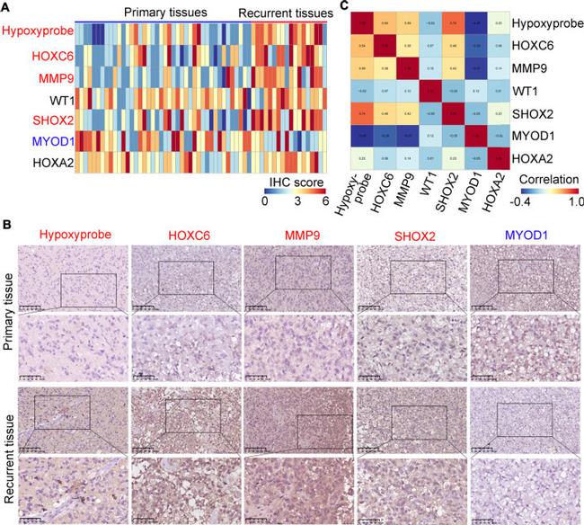 HOXC6 Antibody in Immunohistochemistry (IHC)