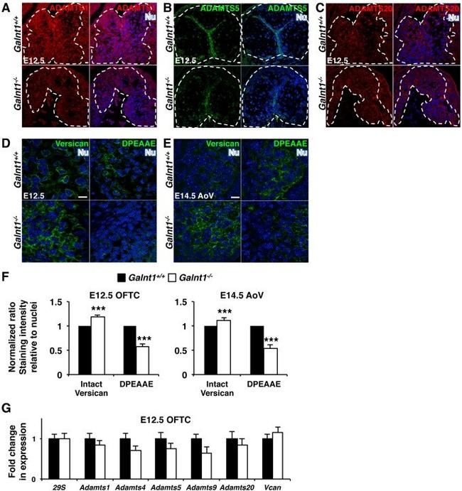 Versican V0, V1 Neo Antibody in Immunohistochemistry (Paraffin) (IHC (P))