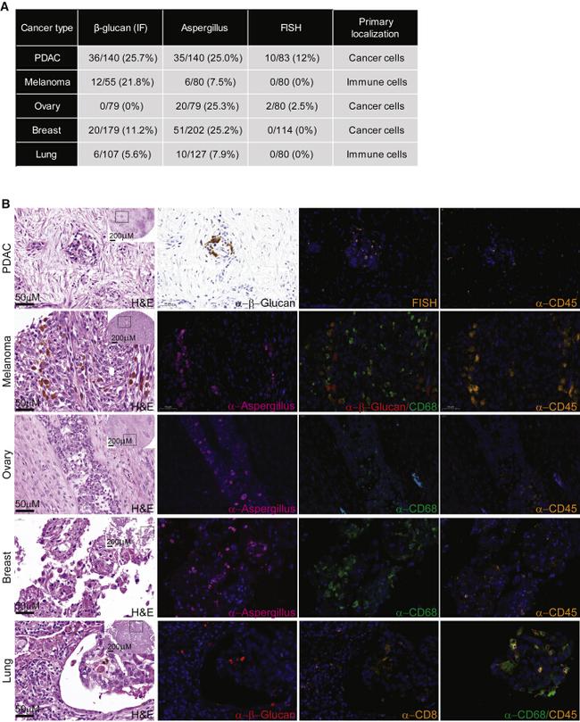 CD45 Antibody in Immunohistochemistry (IHC)