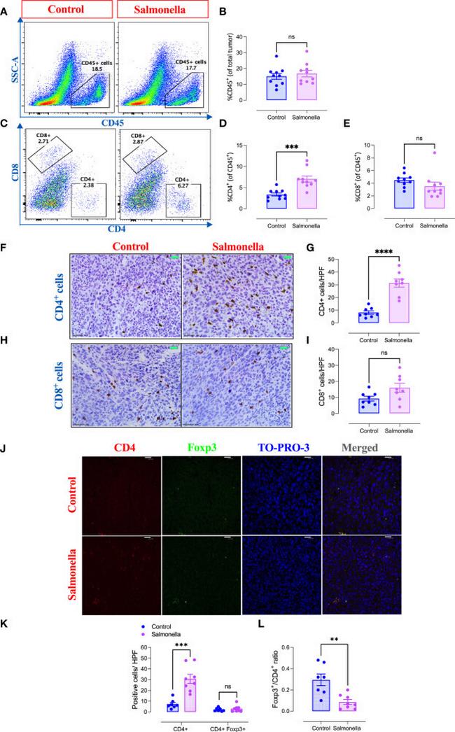 FOXP3 Antibody in Immunohistochemistry (IHC)