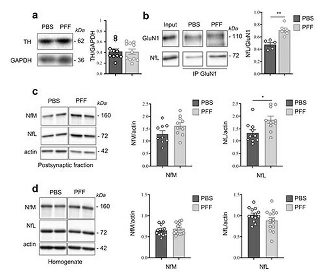 NMDAR1 Antibody in Western Blot (WB)