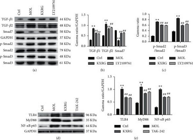 TLR4 Antibody in Western Blot (WB)