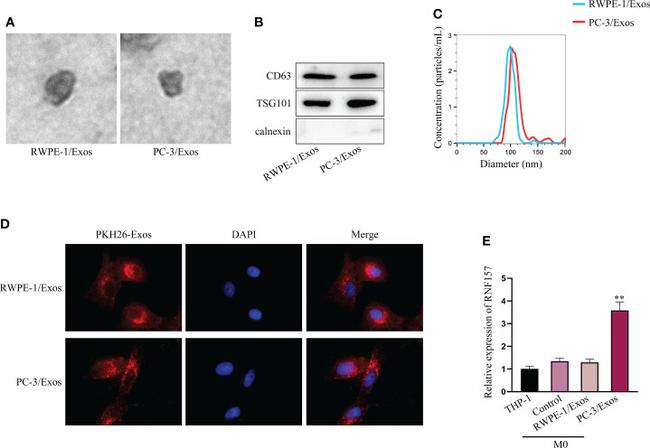 Calnexin Antibody in Western Blot (WB)