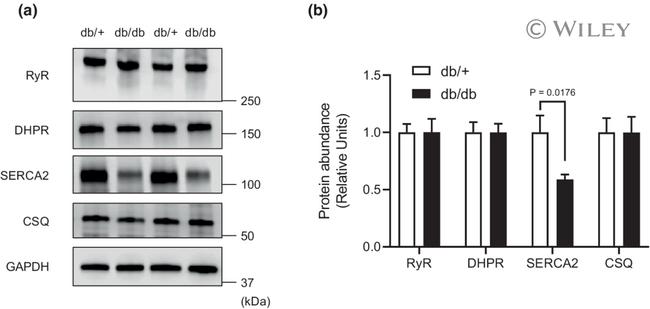 SERCA2 ATPase Antibody in Western Blot (WB)