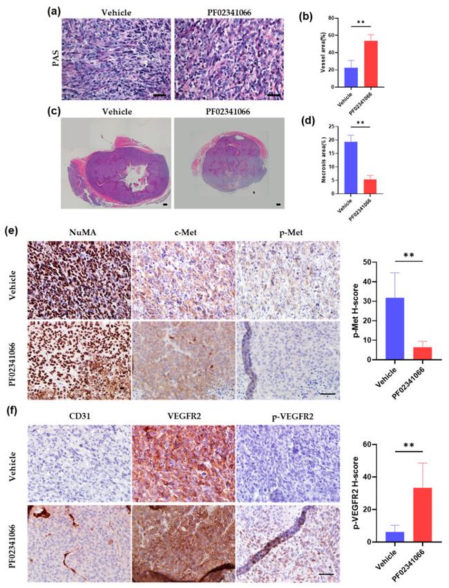 CD31 Antibody in Immunohistochemistry (IHC)