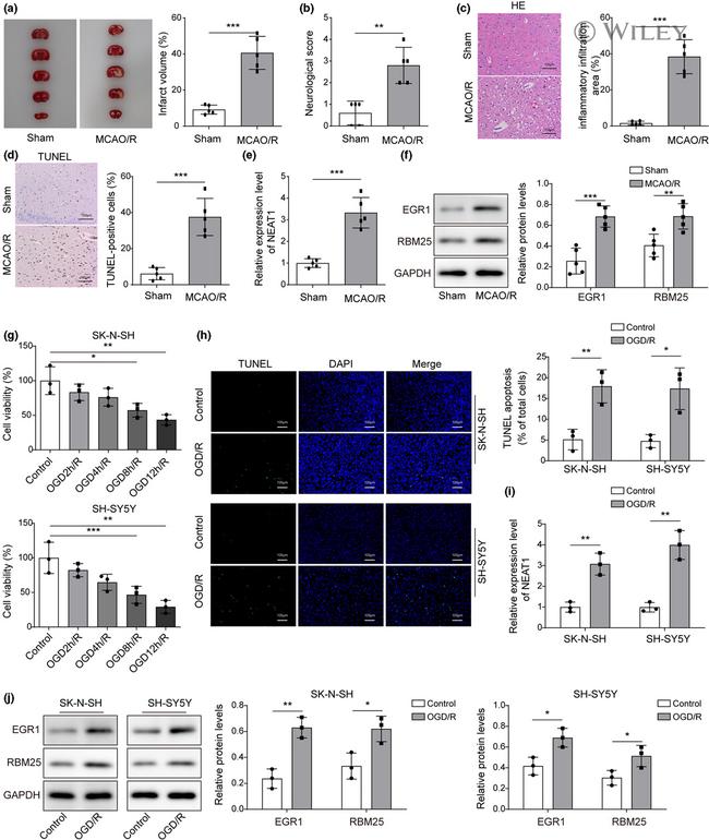 RBM25 Antibody in Western Blot (WB)