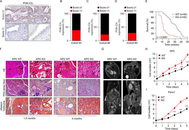 PIK3C2G Antibody in Immunohistochemistry (IHC)