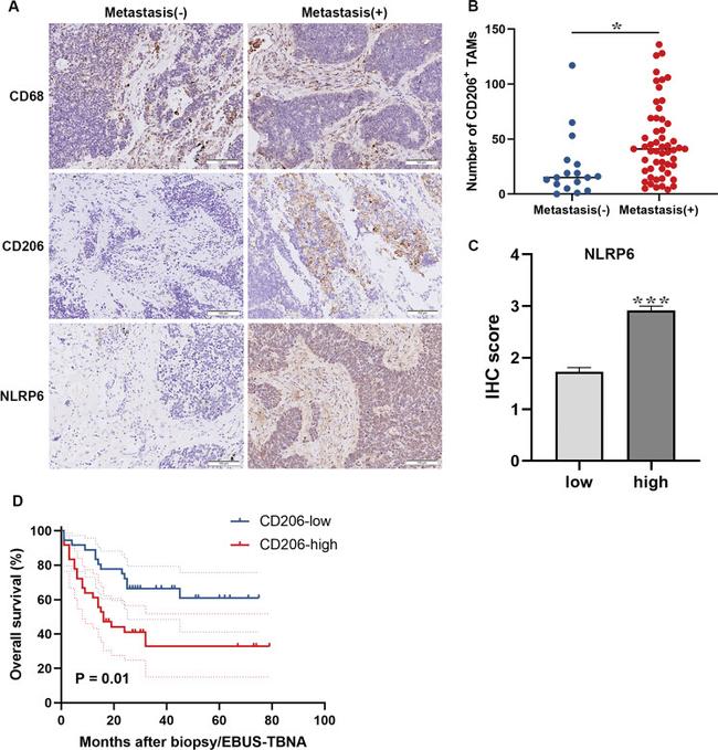 NLRP6 Antibody in Immunohistochemistry (IHC)