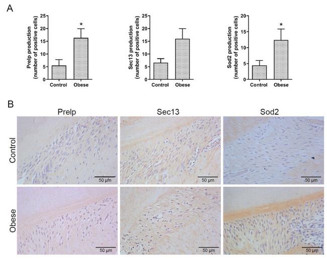 SOD2 Antibody in Immunohistochemistry (IHC)