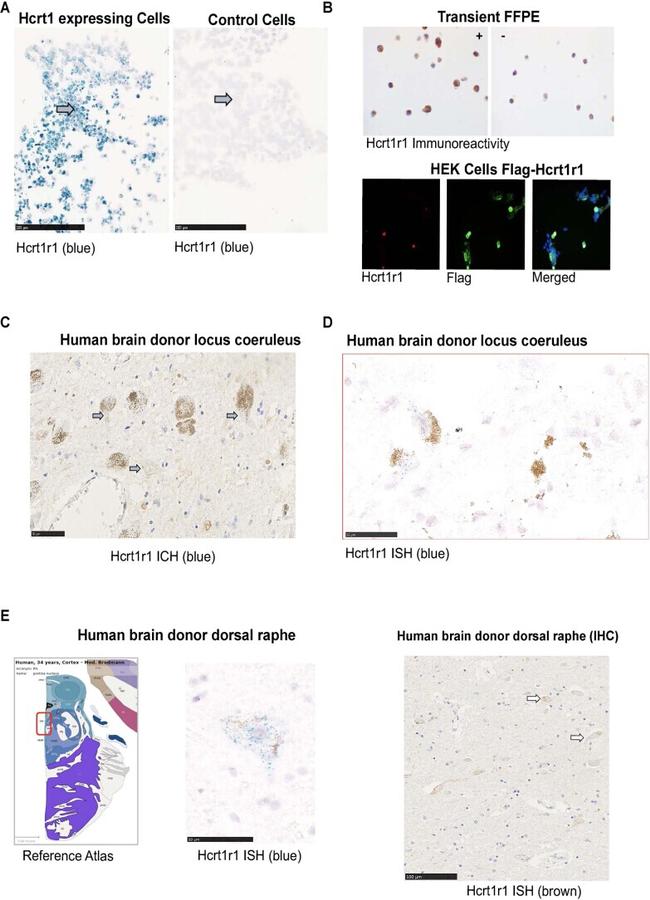 Orexin Receptor 1 Antibody in Immunohistochemistry (IHC)