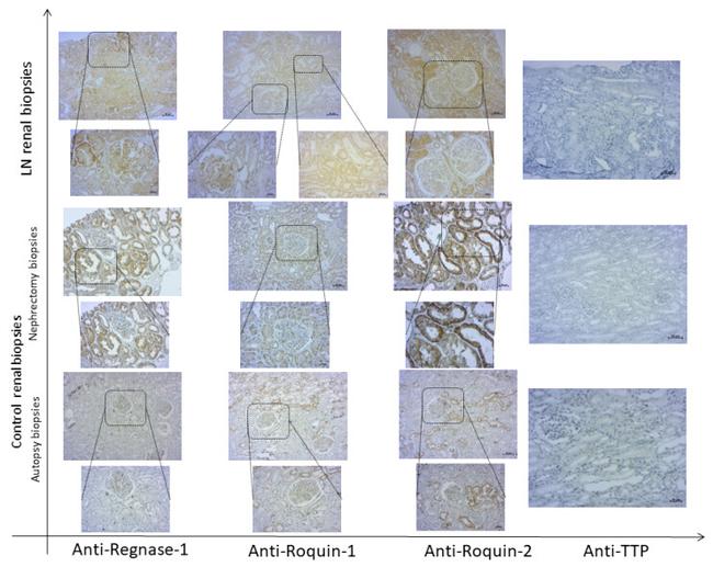 RC3H2 Antibody in Immunohistochemistry (IHC)