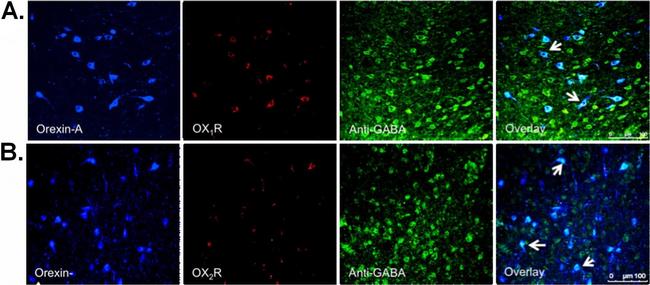 Goat IgG (H+L) Cross-Adsorbed Secondary Antibody in Immunohistochemistry (IHC)