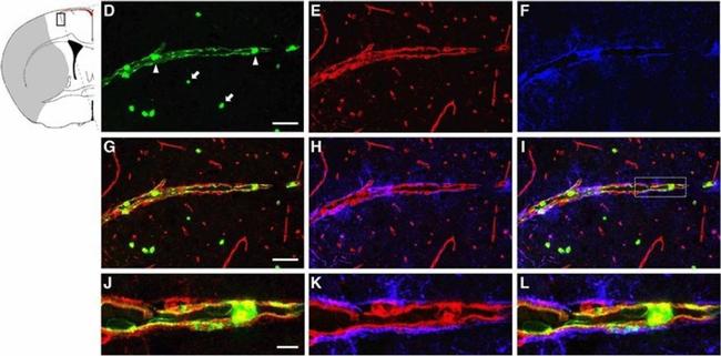 Goat IgG (H+L) Cross-Adsorbed Secondary Antibody in Immunohistochemistry (Paraffin) (IHC (P))