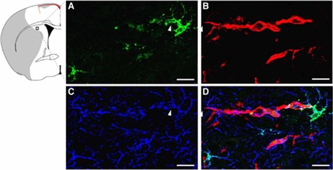 Goat IgG (H+L) Cross-Adsorbed Secondary Antibody in Immunohistochemistry (Paraffin) (IHC (P))