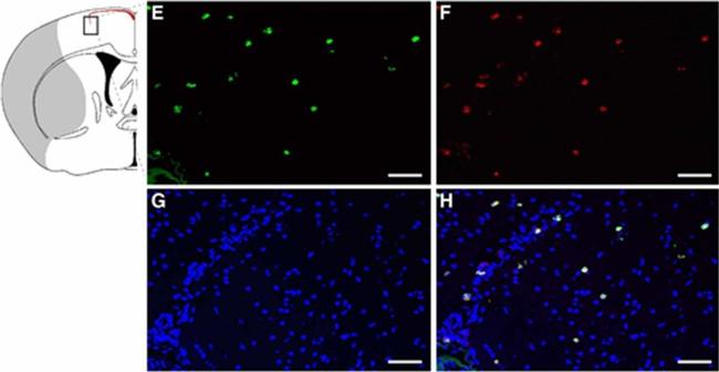 Goat IgG (H+L) Cross-Adsorbed Secondary Antibody in Immunohistochemistry (Paraffin) (IHC (P))