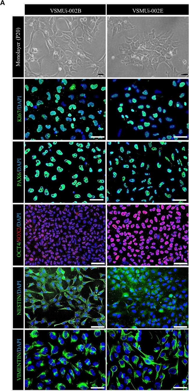 Goat IgG (H+L) Cross-Adsorbed Secondary Antibody in Immunocytochemistry (ICC/IF)