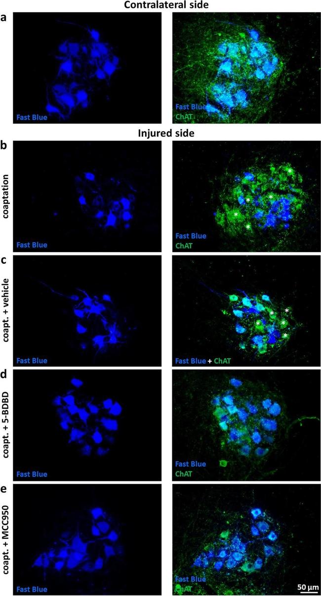 Goat IgG (H+L) Cross-Adsorbed Secondary Antibody in Immunocytochemistry (ICC/IF)