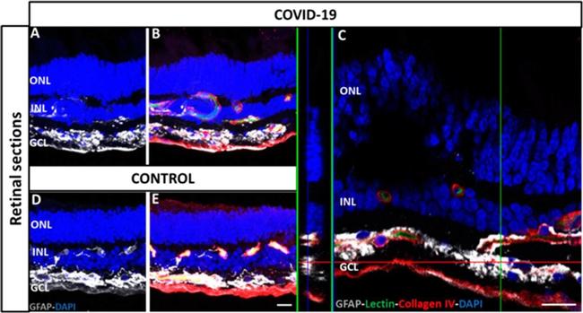 Goat IgG (H+L) Cross-Adsorbed Secondary Antibody in Immunohistochemistry (PFA fixed) (IHC (PFA))