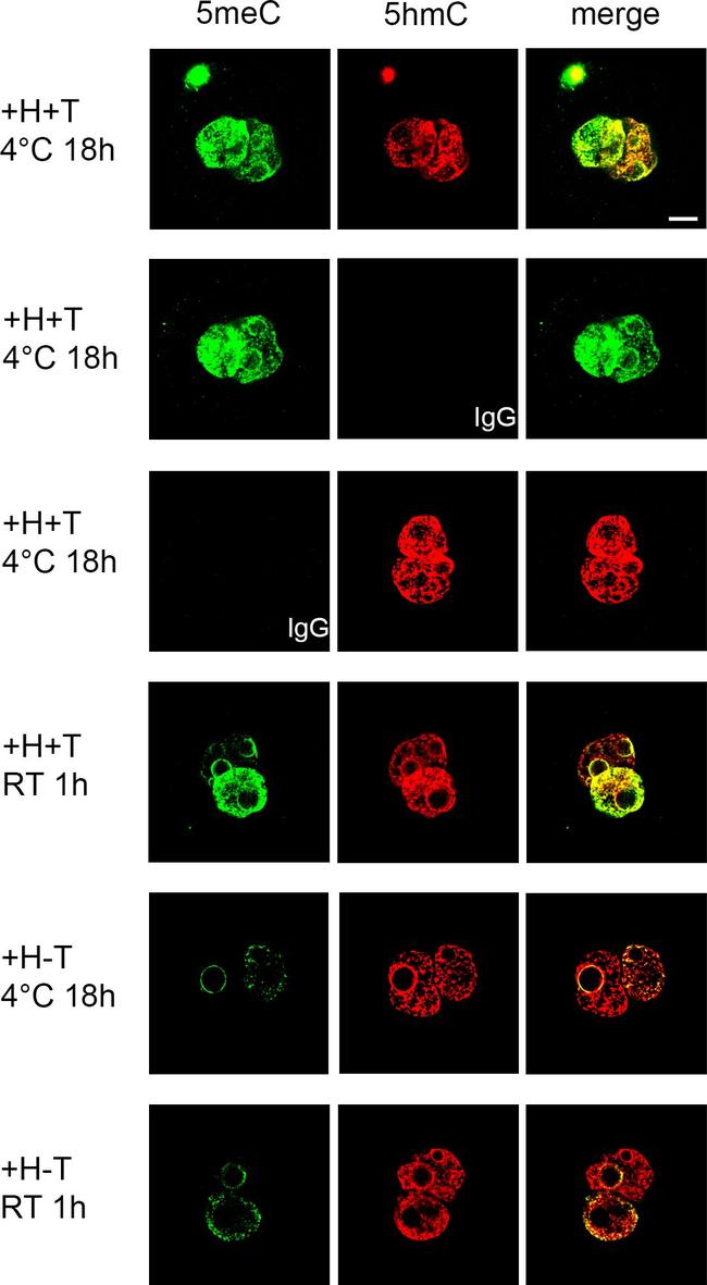 Rabbit IgG (H+L) Highly Cross-Adsorbed Secondary Antibody in Immunohistochemistry (PFA fixed) (IHC (PFA))