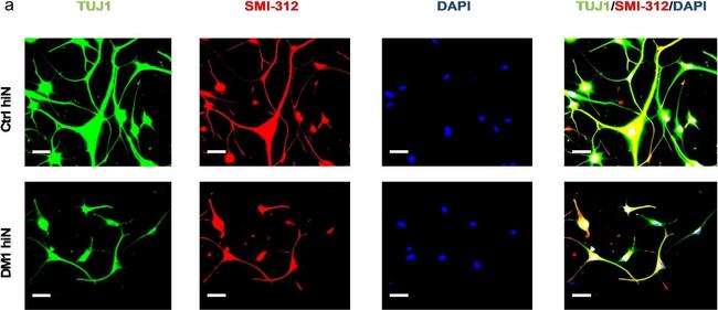 Mouse IgG (H+L) Highly Cross-Adsorbed Secondary Antibody in Immunocytochemistry (ICC/IF)