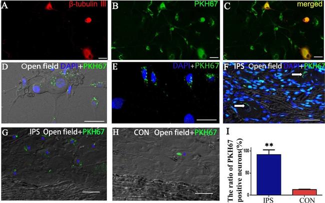 Mouse IgG (H+L) Highly Cross-Adsorbed Secondary Antibody in Immunocytochemistry (ICC/IF)