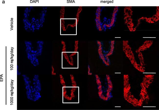 Mouse IgG (H+L) Highly Cross-Adsorbed Secondary Antibody in Immunohistochemistry (Paraffin) (IHC (P))