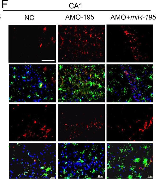 Mouse IgG (H+L) Highly Cross-Adsorbed Secondary Antibody in Immunocytochemistry (ICC/IF)