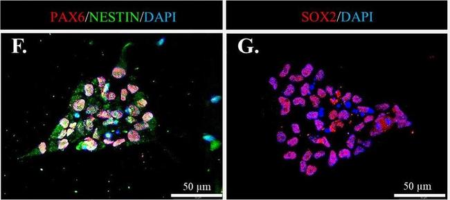 Rabbit IgG (H+L) Highly Cross-Adsorbed Secondary Antibody in Immunocytochemistry (ICC/IF)