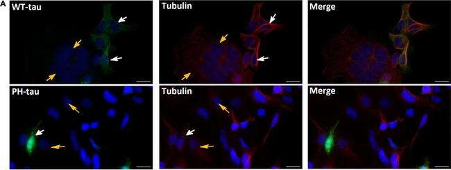 Mouse IgG (H+L) Highly Cross-Adsorbed Secondary Antibody in Immunocytochemistry (ICC/IF)