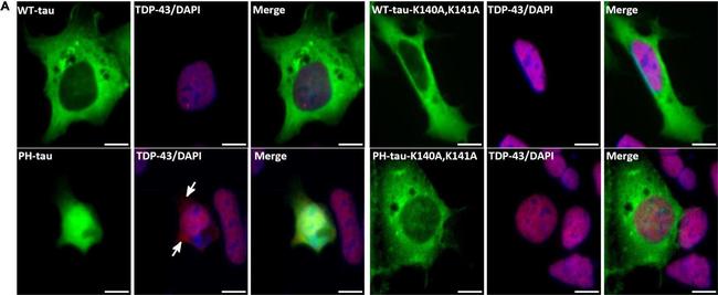 Rabbit IgG (H+L) Highly Cross-Adsorbed Secondary Antibody in Immunocytochemistry (ICC/IF)