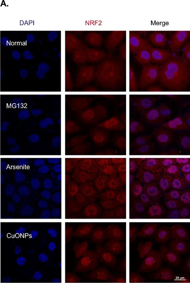 Rabbit IgG (H+L) Highly Cross-Adsorbed Secondary Antibody in Immunocytochemistry (ICC/IF)