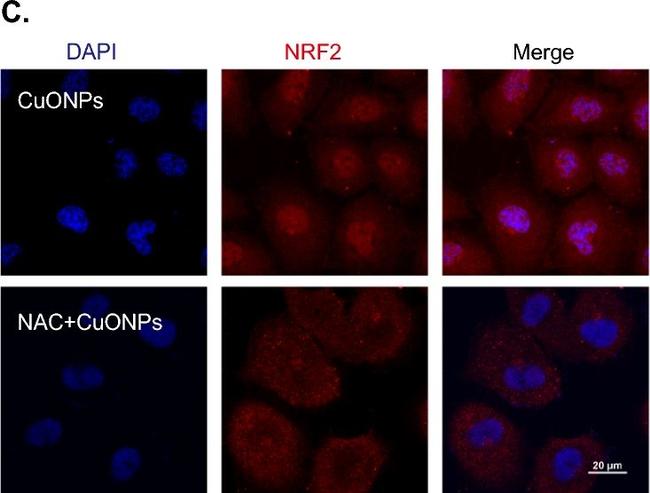 Rabbit IgG (H+L) Highly Cross-Adsorbed Secondary Antibody in Immunocytochemistry (ICC/IF)