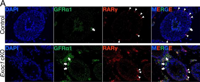 Rabbit IgG (Heavy chain) Secondary Antibody in Immunohistochemistry (Paraffin) (IHC (P))